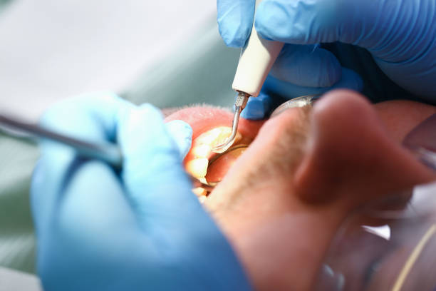 Best Emergency Cosmetic Dentistry (e.g., broken veneers) in Hugoton, KS